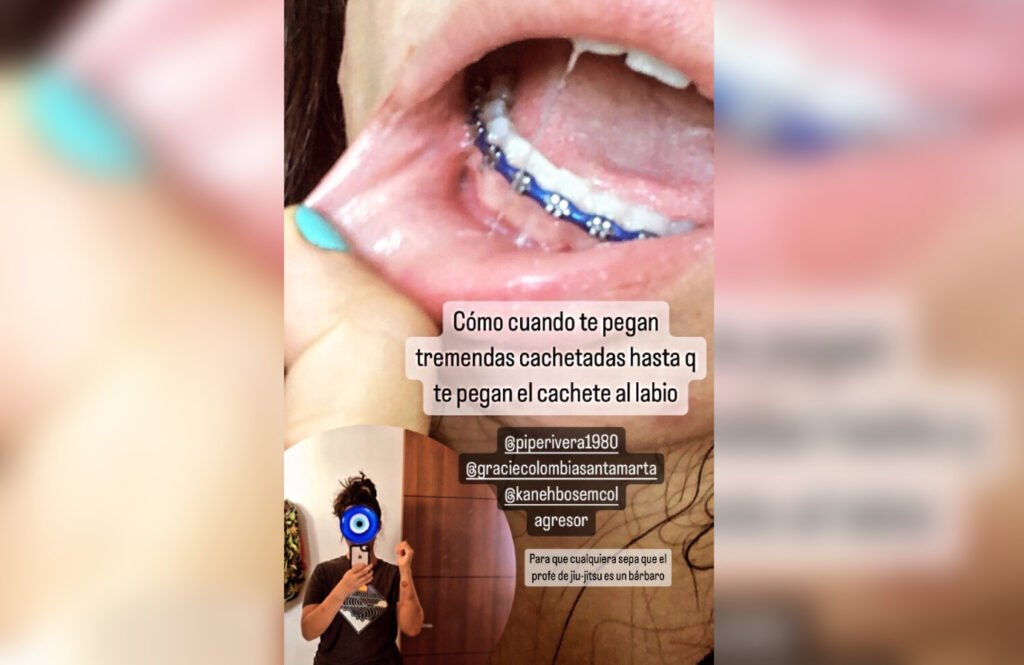 El mensaje de la agresión que Valentina no publicó en Instagram.